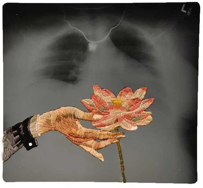 Artist Embroiders X-Rays And It's Beautiful And Creepy At The Same Time