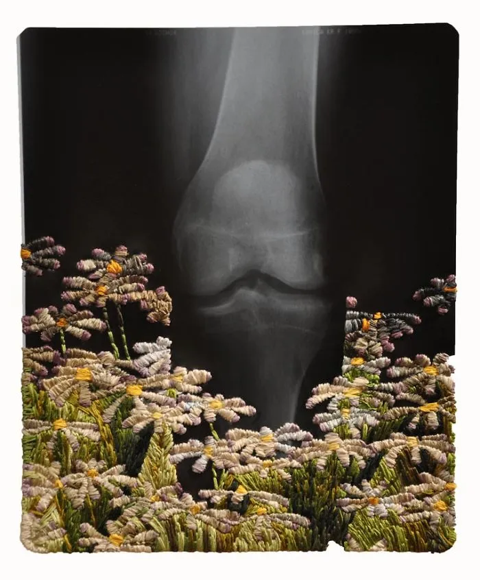 Artist Embroiders X-Rays And It's Beautiful And Creepy At The Same Time