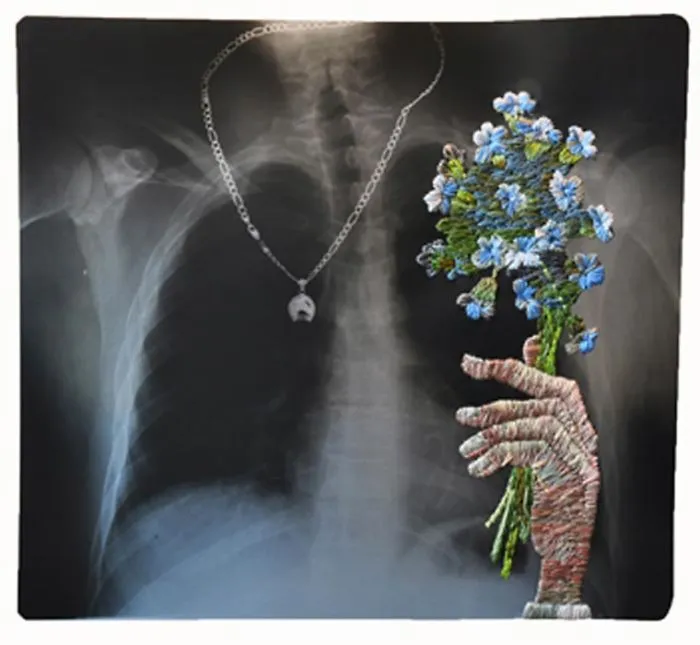 Artist Embroiders X-Rays And It's Beautiful And Creepy At The Same Time