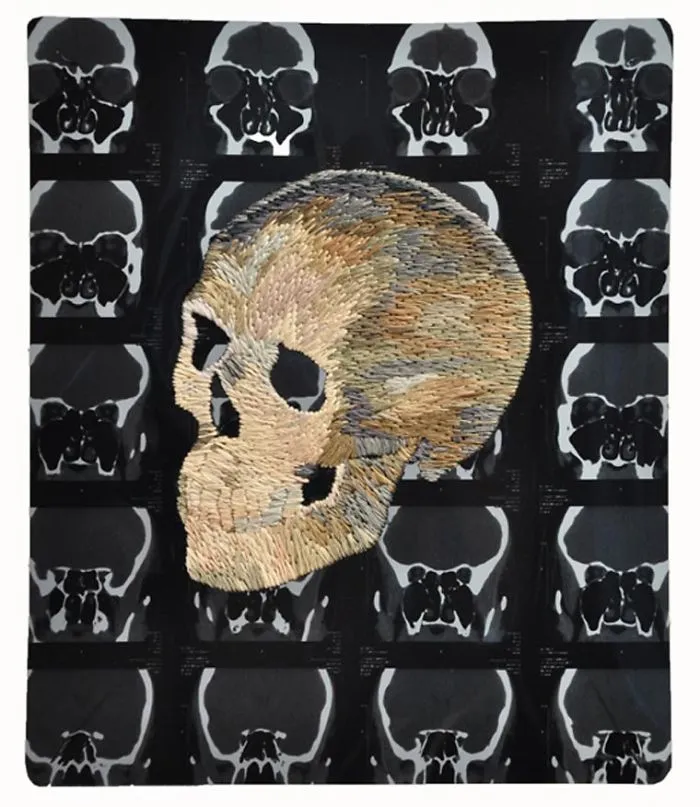 Artist Embroiders X-Rays And It's Beautiful And Creepy At The Same Time