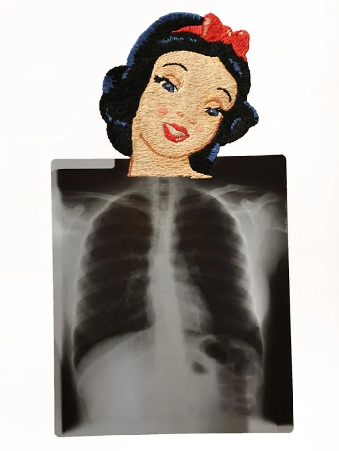 Artist Embroiders X-Rays And It's Beautiful And Creepy At The Same Time