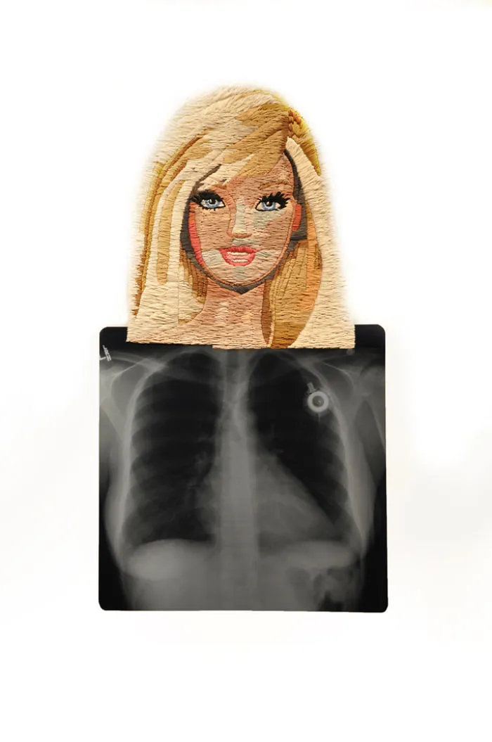 Artist Embroiders X-Rays And It's Beautiful And Creepy At The Same Time