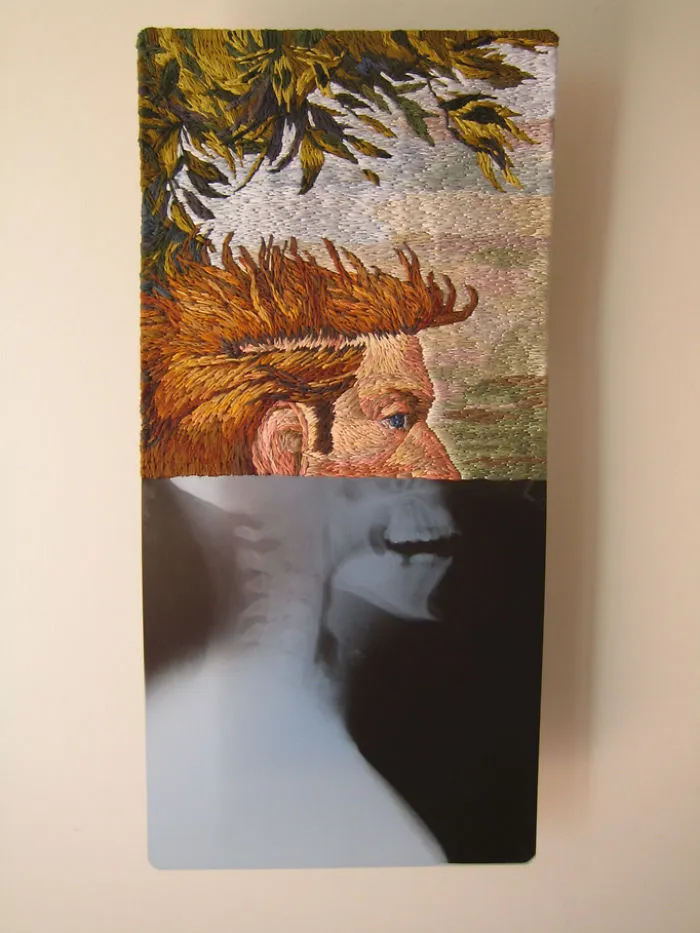 Artist Embroiders X-Rays And It's Beautiful And Creepy At The Same Time