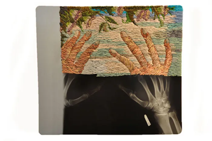 Artist Embroiders X-Rays And It's Beautiful And Creepy At The Same Time