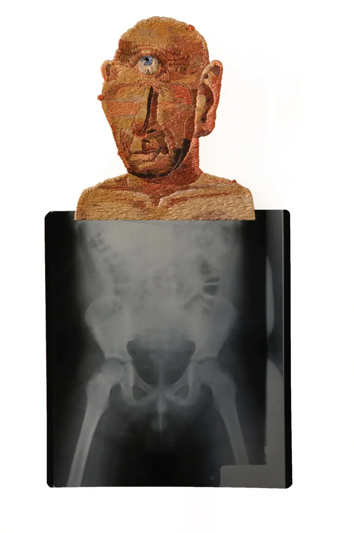 Artist Embroiders X-Rays And It's Beautiful And Creepy At The Same Time
