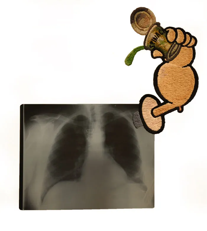 Artist Embroiders X-Rays And It's Beautiful And Creepy At The Same Time