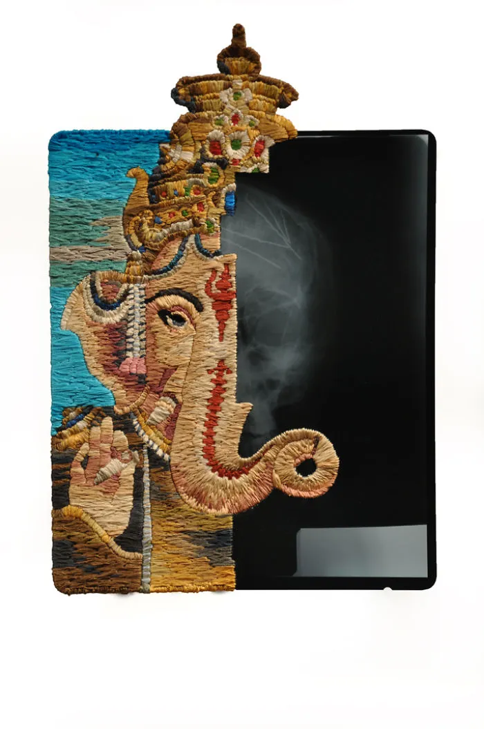 Artist Embroiders X-Rays And It's Beautiful And Creepy At The Same Time