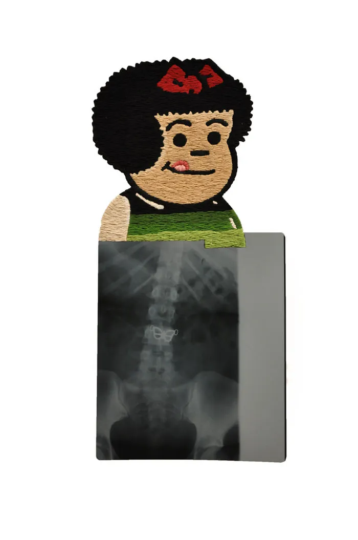 Artist Embroiders X-Rays And It's Beautiful And Creepy At The Same Time