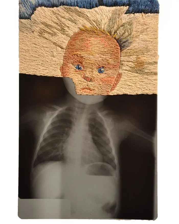 Artist Embroiders X-Rays And It's Beautiful And Creepy At The Same Time