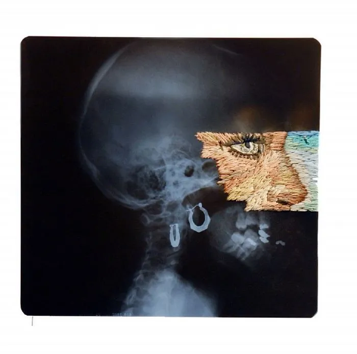 Artist Embroiders X-Rays And It's Beautiful And Creepy At The Same Time