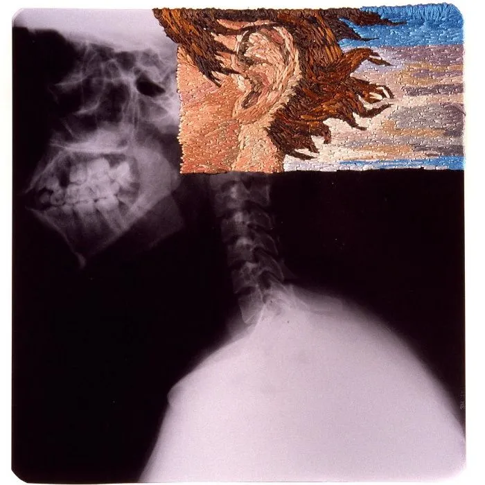 Artist Embroiders X-Rays And It's Beautiful And Creepy At The Same Time