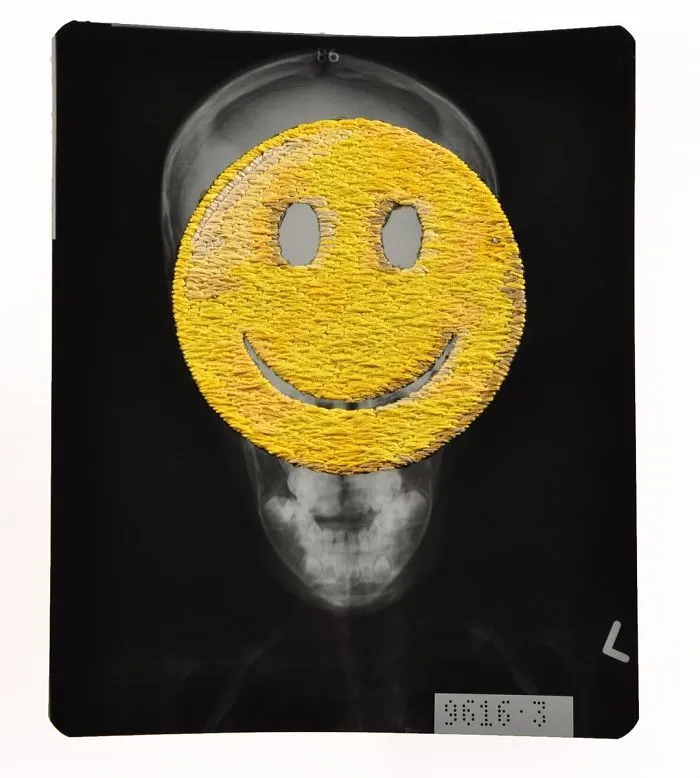 Artist Embroiders X-Rays And It's Beautiful And Creepy At The Same Time