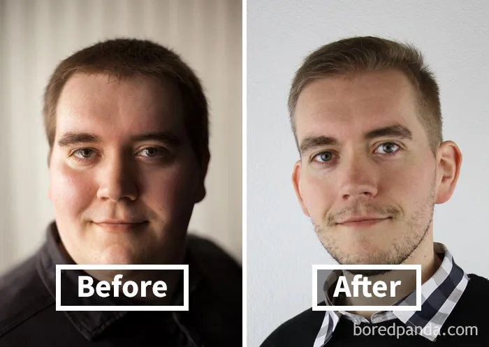 Before and after photo of face fat loss, showing noticeable weight loss transformation.