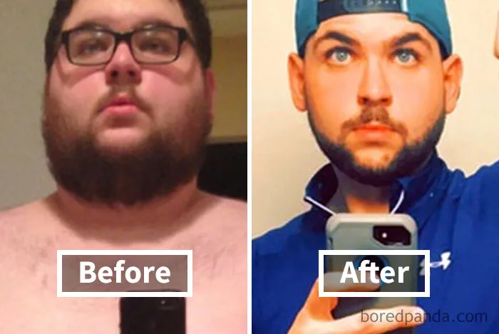 Before and after image showing face fat loss during weight loss journey, with noticeable changes in facial structure.