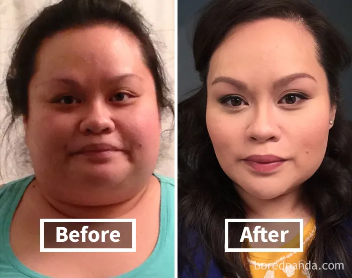 Before and after face fat loss showcasing noticeable changes in facial features.