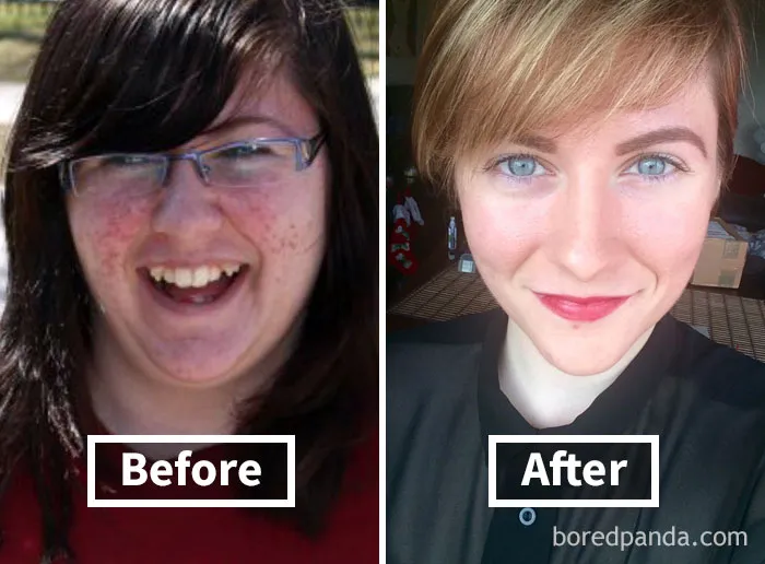 Before and after face fat loss photo showing significant transformation.