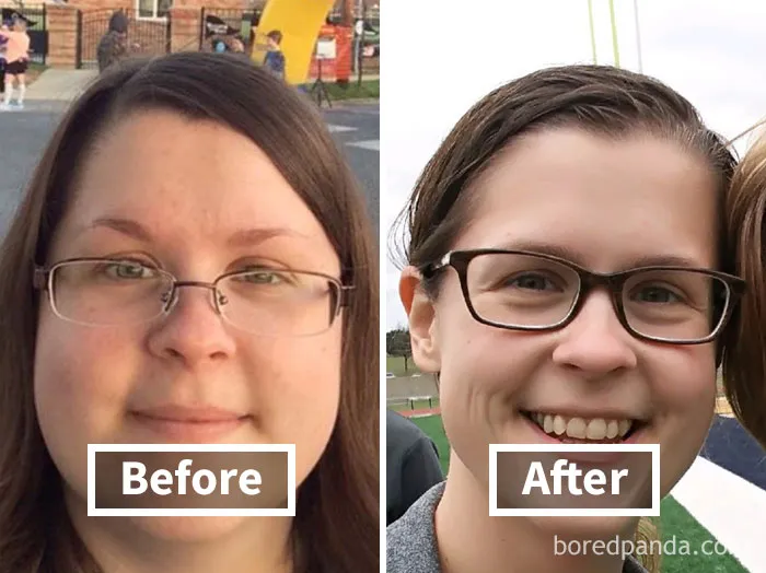 Before and after face fat loss comparison, showing noticeable weight loss transformation.