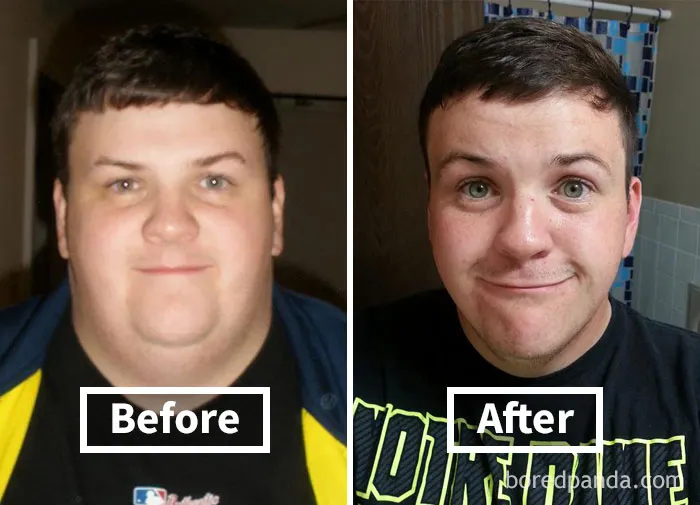 Face fat loss before and after weight loss showing noticeable transformation in facial features.