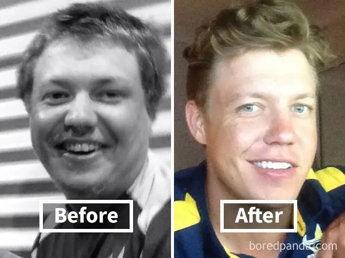 Before and after comparison of face fat loss, showing significant transformation.