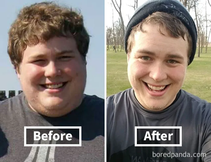 Before and after photos showcasing face fat loss from weight loss transformation.