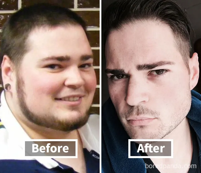 Before and after face fat loss transformation, showing significant weight reduction.