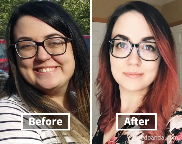 Before and after face fat loss transformation showcasing noticeable changes in appearance.