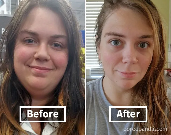 Before and after weight loss face fat transformation of a woman, showcasing significant changes in facial structure.