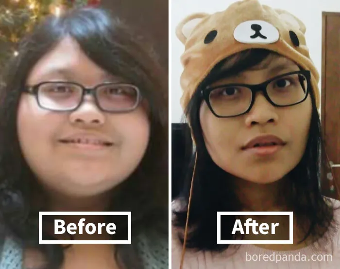 Before and after weight loss face transformation showcasing face fat loss.