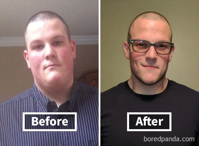 Before and after photos showing face fat loss results after weight loss journey.