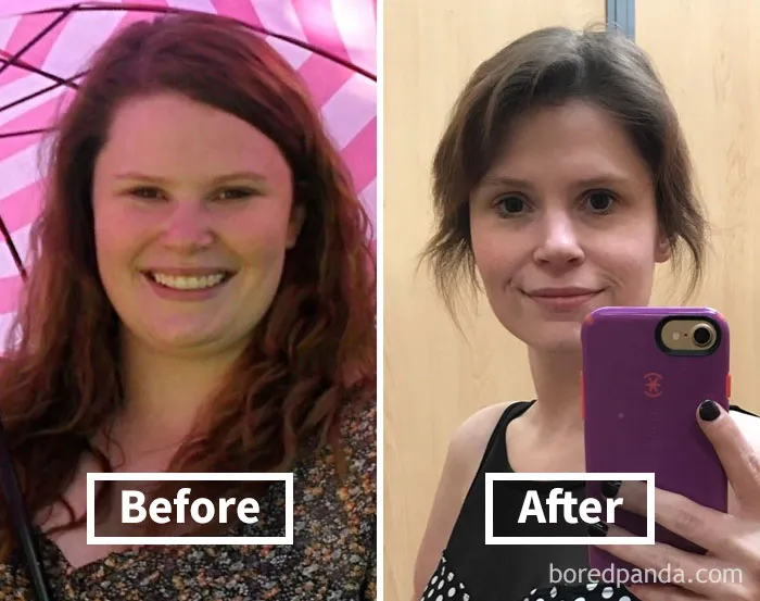 Face fat loss transformation with before and after photos.