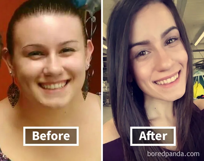 Before and after weight loss face fat reduction showing significant change in appearance.