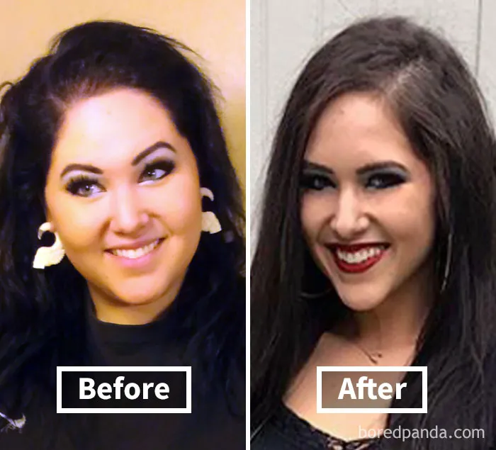 Before and after image showing face fat loss in a weight loss transformation.