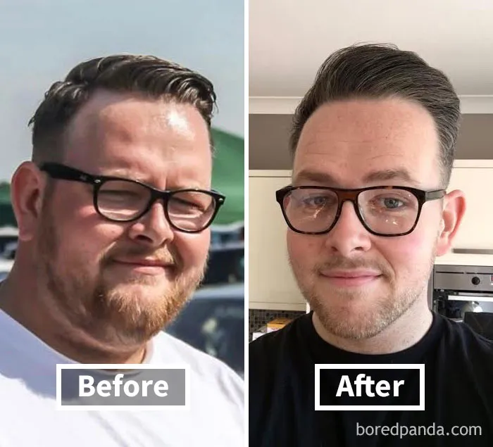 "Face fat loss before and after: man with glasses shows visible weight loss transformation."