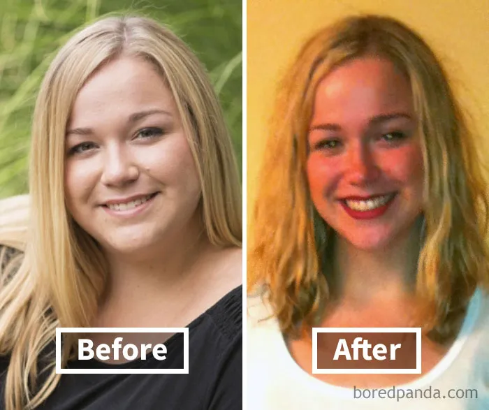 Face fat loss transformation shown in before and after photos, highlighting weight loss impact.