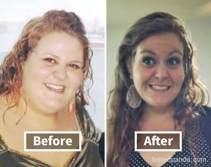 Before and after photos showing face fat loss after weight loss.