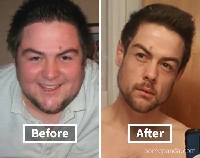 Before and after photos showing face fat loss and weight reduction transformation.