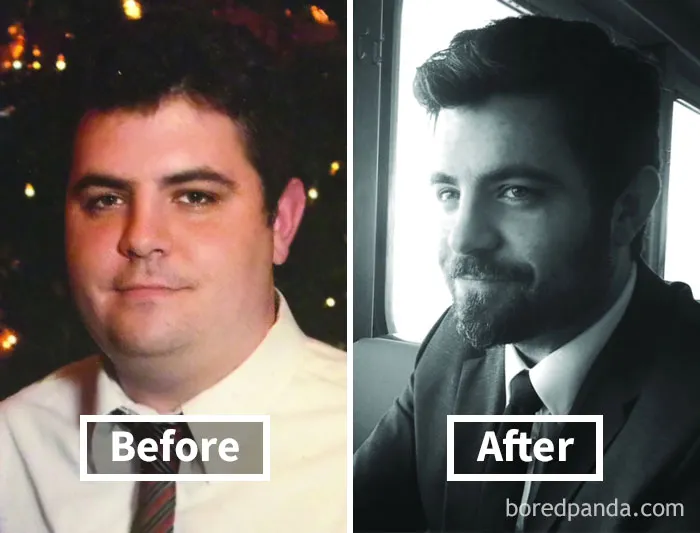Before and after face fat loss comparison, highlighting changes following weight loss.