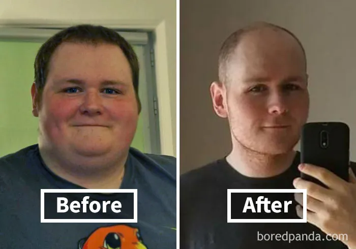 Face fat loss transformation shown in before and after weight loss photos.