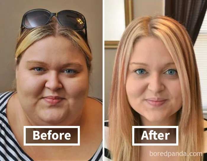 Before and after comparison showing face fat loss following weight loss transformation.