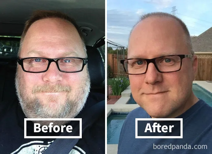 Face fat loss before and after weight loss transformation, featuring a man with glasses.