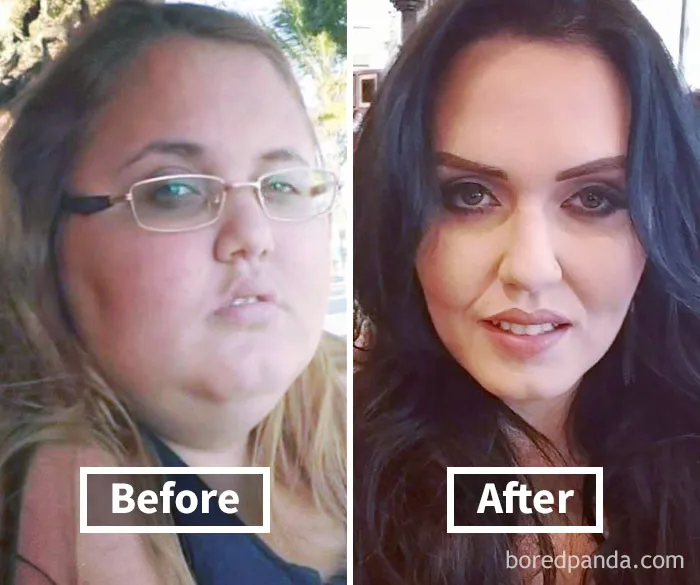 Before and after photos showing a woman's face fat loss transformation after weight loss.