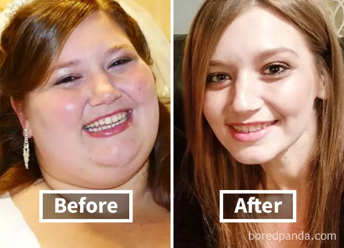 Before and after face fat loss in weight loss transformation photo.
