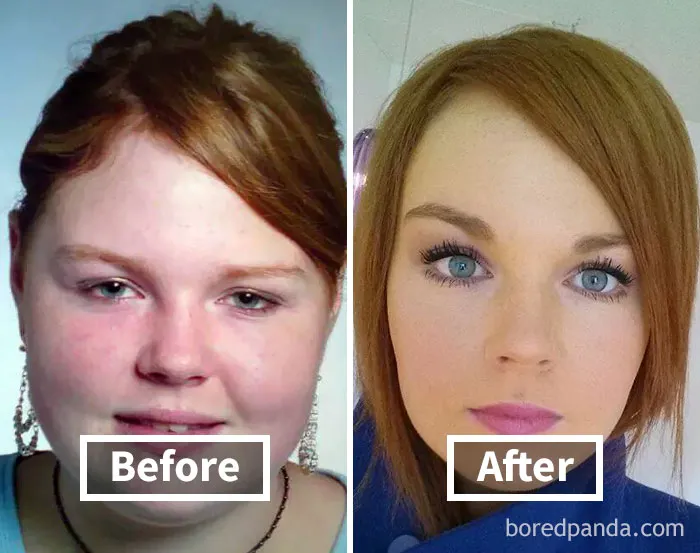 Face fat loss before and after weight loss transformation photo comparison.
