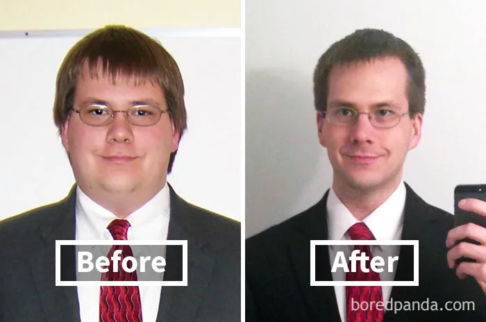 Before and after face fat loss transformation, showing weight loss effects.