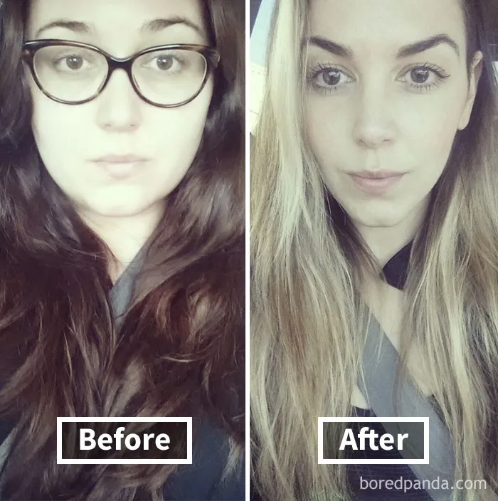 Before and after weight loss showing face fat loss transformation.
