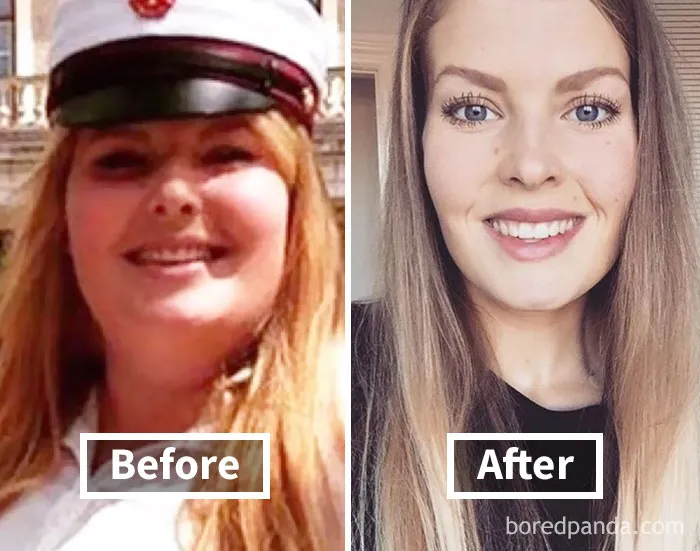 Before and after face fat loss photos showing significant weight loss transformation.