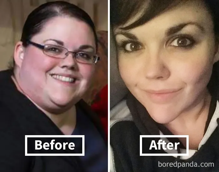 "Before and after face fat loss showing significant transformation."