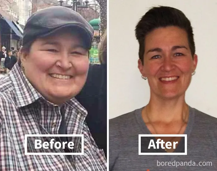 Before and after face fat loss highlighting transformation through weight loss.