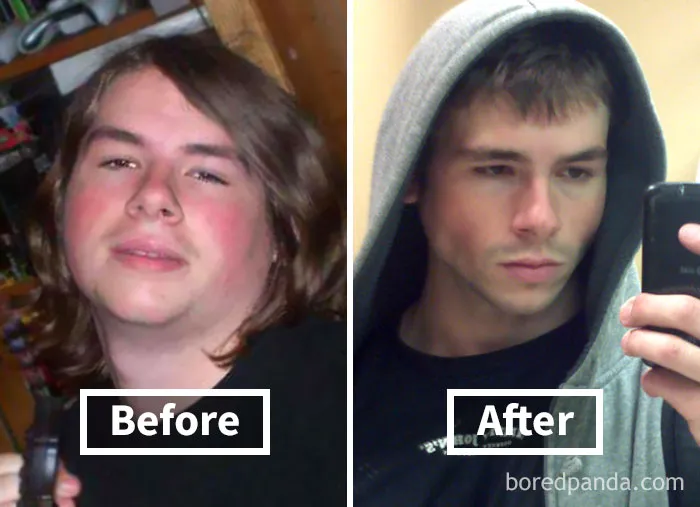 Before and after comparison of face fat loss results in young man, showing noticeable weight loss transformation.