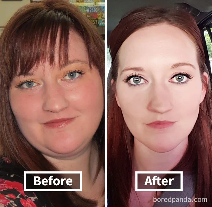 Before and after face fat loss comparison showing significant changes in facial features.